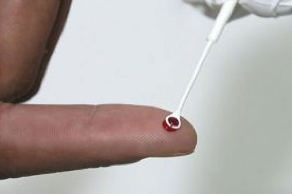 Medicamento injetvel  nova opo de preveno contra HIV no Brasil